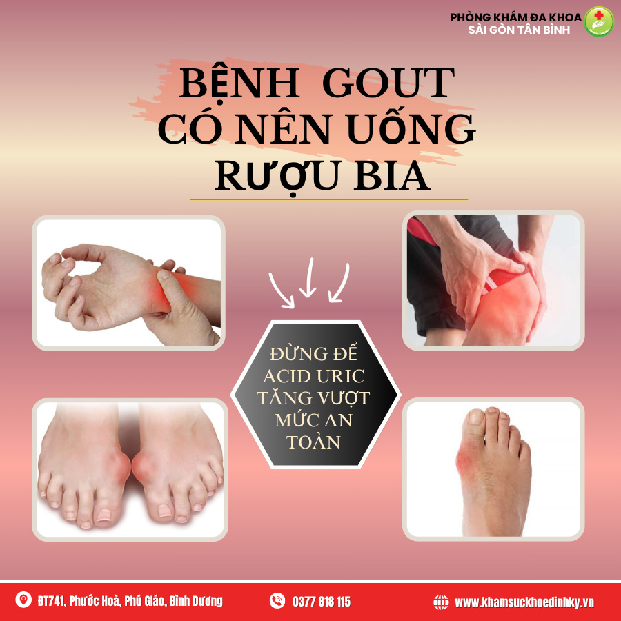 /tin-tuc-su-kien/benh-gout-co-nen-uong-ruou-bia